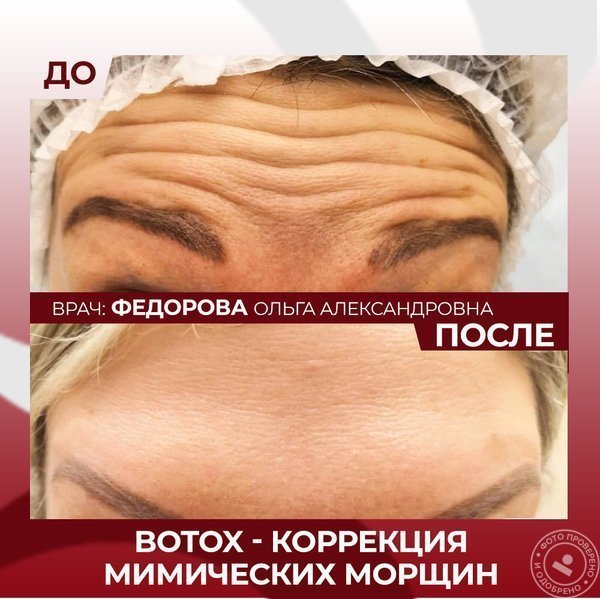 Косметологическая клиника Институт красоты на Гороховой улице, 6 - фото 5