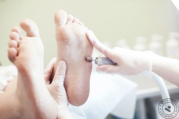 Ногтевая клиника Nail Clinic - фото 4