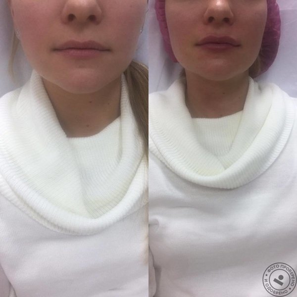 Центр эстетики и косметологии «Баллирано» - фото 10